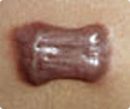 ���ݷ���Ƥ����ҽԺ